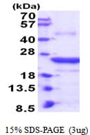Human CLEC4E / MINCLE Protein (Recombinant His)