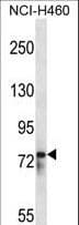 Polyclonal Rabbit anti-Human RBM12 Antibody (aa575-603, IHC, WB)