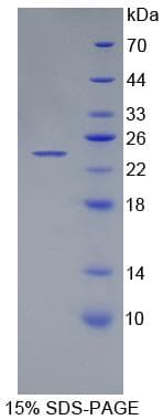 Human CNDP1 Protein (Recombinant His-T7)