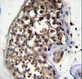 FBXO15 / FBX15 Antibody (aa130-158)