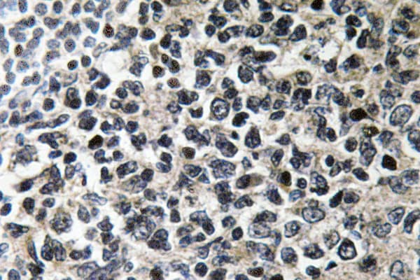 VASP Antibody (His151)