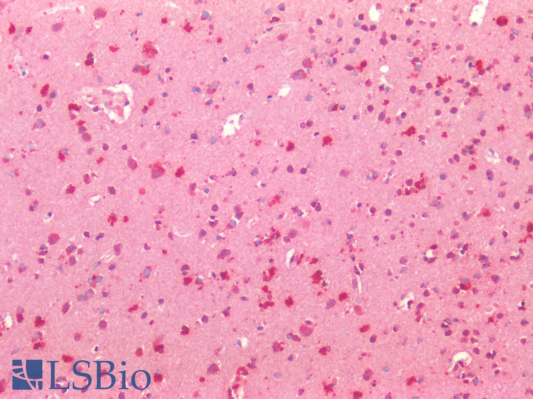 IHC-plus™ Polyclonal Rabbit anti-Rat HTR1A / 5-HT1A Receptor Antibody (Internal, IHC, WB)