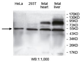 Polyclonal Rabbit anti-Human Basigin / Emmprin / CD147 Antibody (aa22-208, WB)