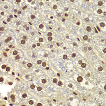 DDX5 Antibody