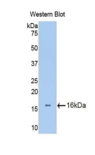 ACAN / Aggrecan Antibody (aa34-147)