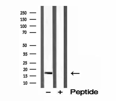 CPLX1 / Complexin 1 Antibody