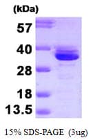 Human ANXA3 / Annexin A3 Protein (Recombinant)