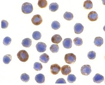 BIRC8 / ILP2 Antibody (aa2-13)