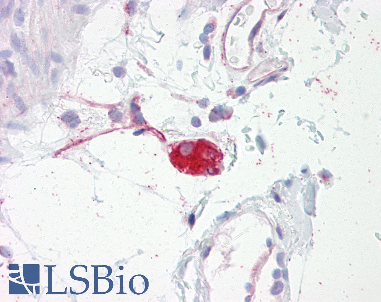 IHC-plus™ Polyclonal Rabbit anti-Human ADRA2A Antibody (aa331-380, IHC, IF, WB)