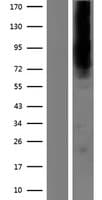 KCNN2 Protein (Over-Expression Lysate Myc-DDK (Flag))