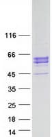 Human ITPKA Protein (Recombinant Myc-DDK (Flag))