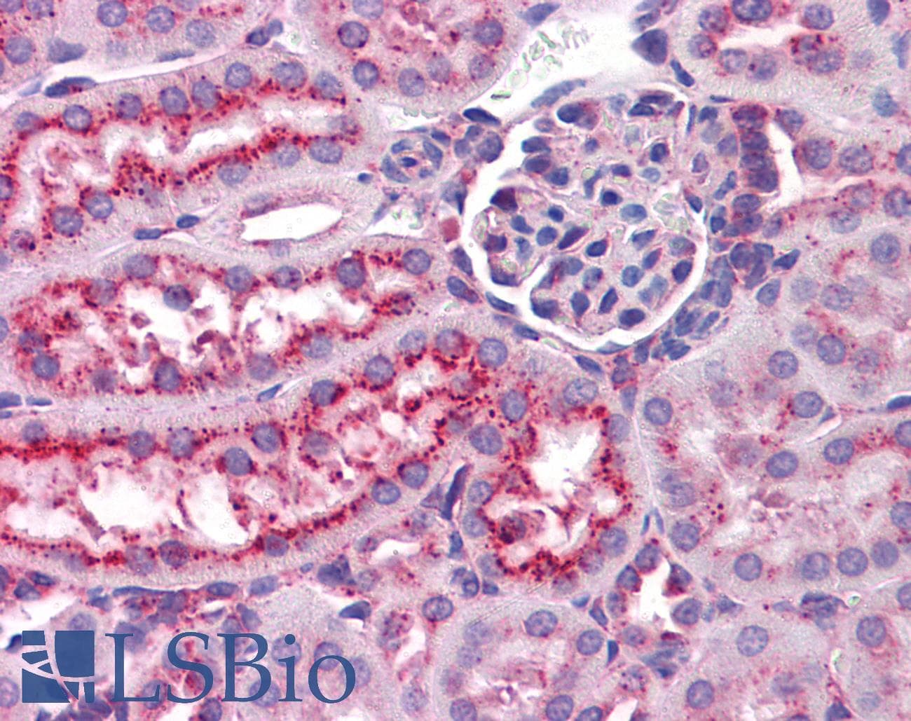 IHC-plus™ Monoclonal Rat anti-Mouse LAMP1 / CD107a Antibody (FITC, IHC, WB)