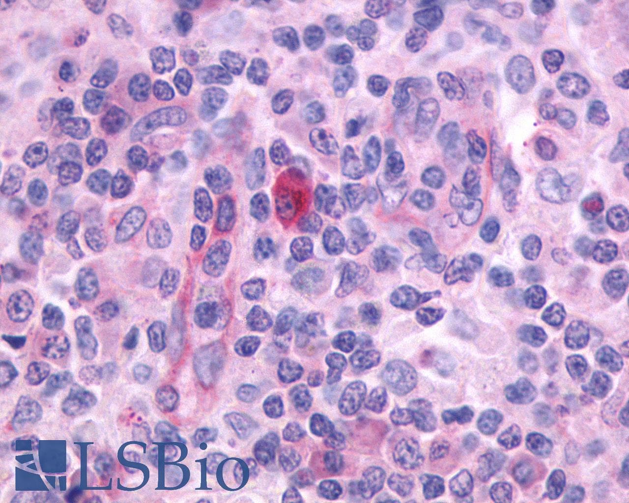 PathPlus™ ADGRE5 / CD97 Antibody (N-Terminus)