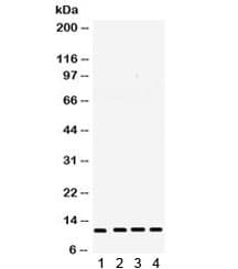 Polyclonal Rabbit anti-Human CSTB / Cystatin B / Stefin B Antibody (IHC, WB)