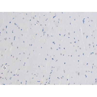 STAT3 Antibody (phospho-Ser727)