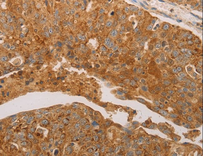 PRDX3 / Peroxiredoxin 3 Antibody