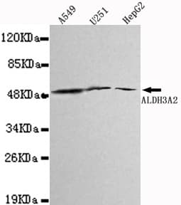 ALDH3A2 Antibody
