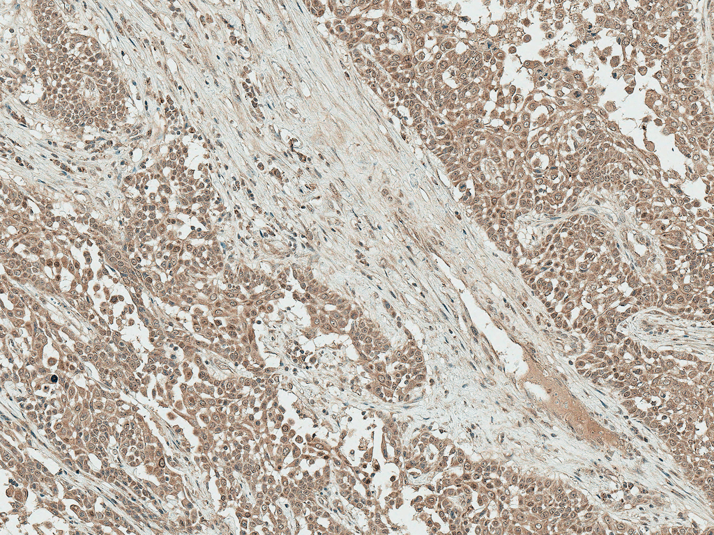 IGF1 Antibody (Biotin)