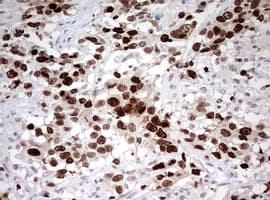 TOP2A / Topoisomerase II Alpha Antibody (aa1100-1531, clone OTI2A9)