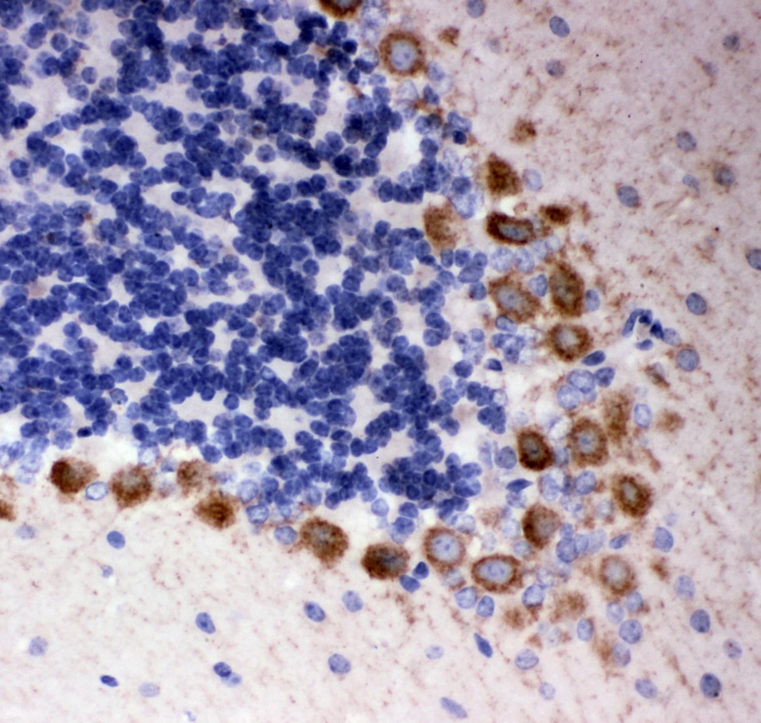 Polyclonal Rabbit anti-Human DISC1 Antibody (aa461-477, IHC, WB)