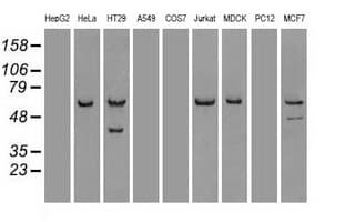 CHEK2 / CHK2 Antibody (clone OTI2H5)