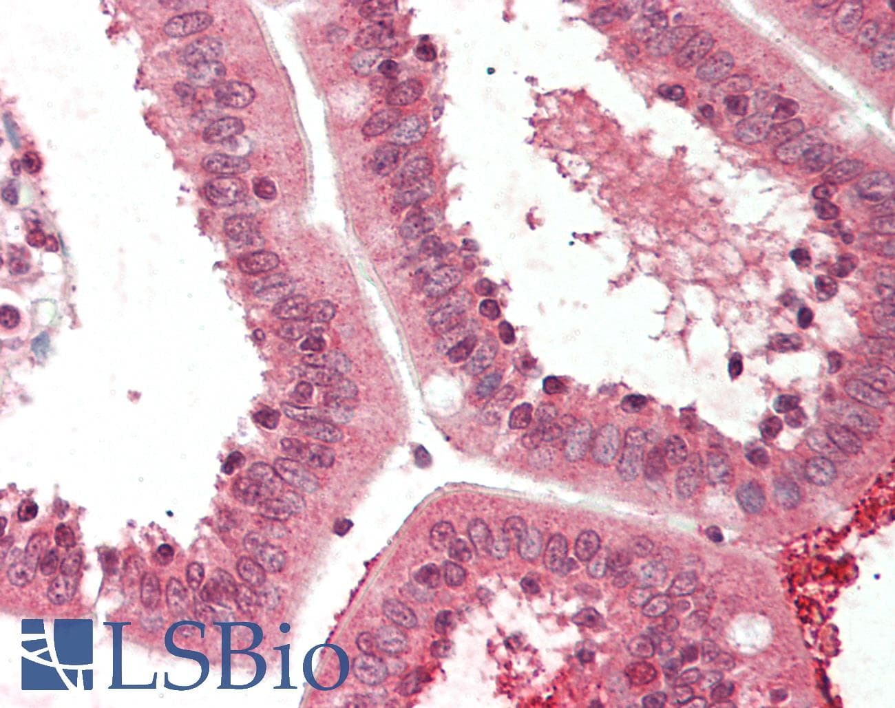 IHC-plus™ Polyclonal Rabbit anti-Human CTHRC1 Antibody (C-Terminus, IHC, WB)