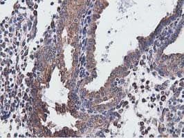 CYB5R3 / B5R Antibody (clone OTI2A10)