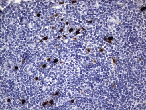 S100A9 / MRP14 Antibody (clone OTI3C12)