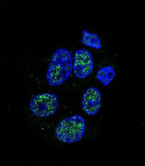 NOS3 / eNOS Antibody (Ser1177)