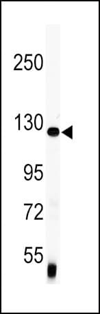 VCL / Vinculin Antibody (aa1012-1039)