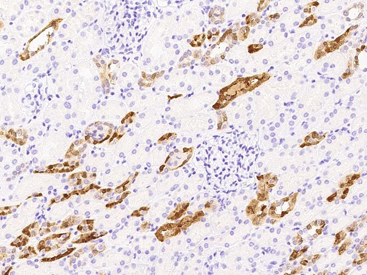 Polyclonal Rabbit anti-Human PVALB / Parvalbumin Antibody (Preservative Free, IHC)