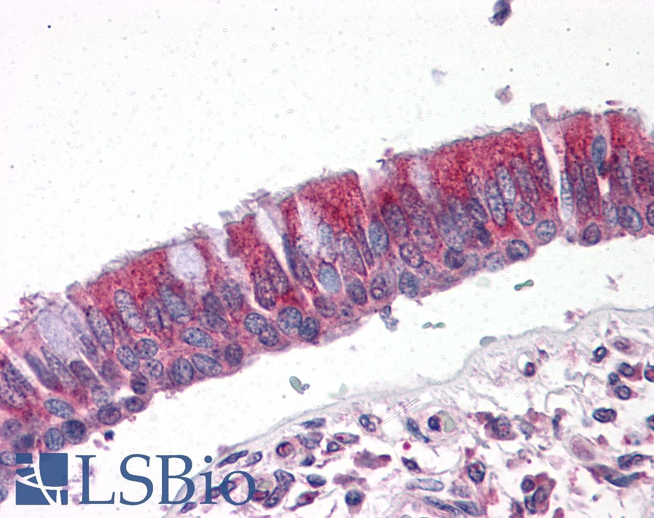IHC-plus™ CCT2 / CCT Beta Antibody