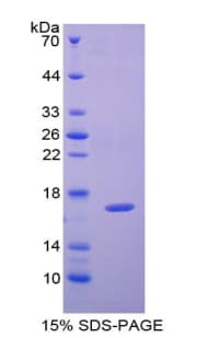 Human CAP2 Protein (Recombinant His)