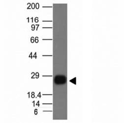 HLA-DRB1 Antibody (clone HLA-DRB/1067)