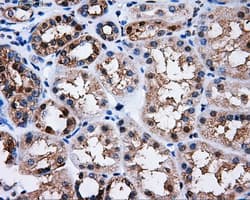 PME-1 / PPME1 Antibody (clone OTI4A12)