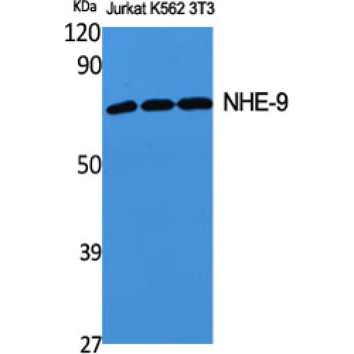 Polyclonal Rabbit anti-Human SLC9A9 / NHE9 Antibody (140-220 aa, Internal, WB)