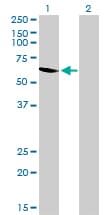 UGP2 Antibody (clone 3H3)