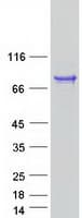 Human AMZ1 Protein (Recombinant Myc-DDK (Flag))