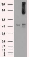 Monoclonal Mouse anti-Human BRAF / B-Raf Antibody (clone OTI1E2, IHC, IF, WB)