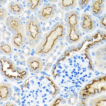 RPS2 / Ribosomal Protein S2 Antibody