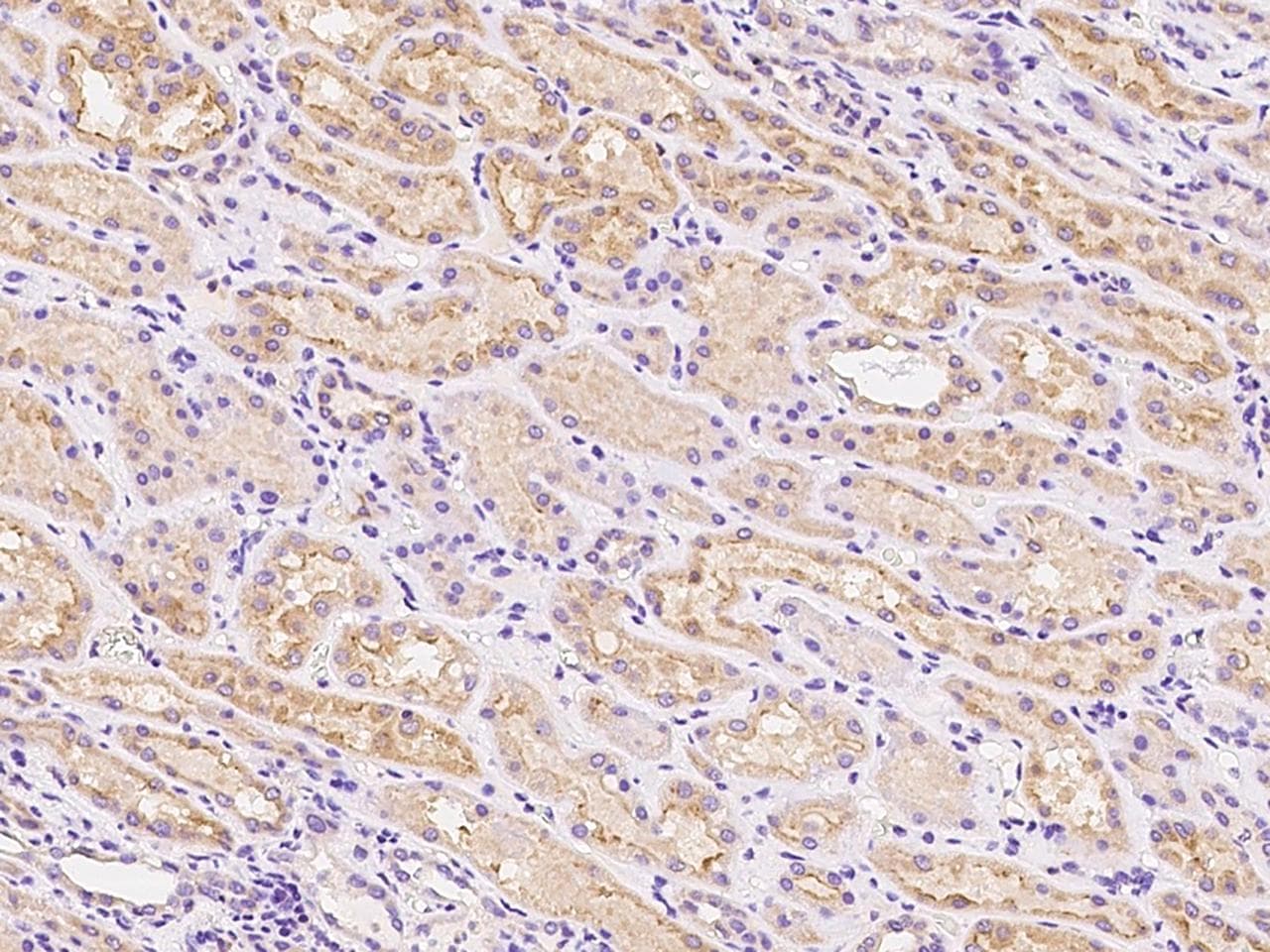 Polyclonal Rabbit anti-Human EPHA4 / EPH Receptor A4 Antibody (Preservative Free, IHC)