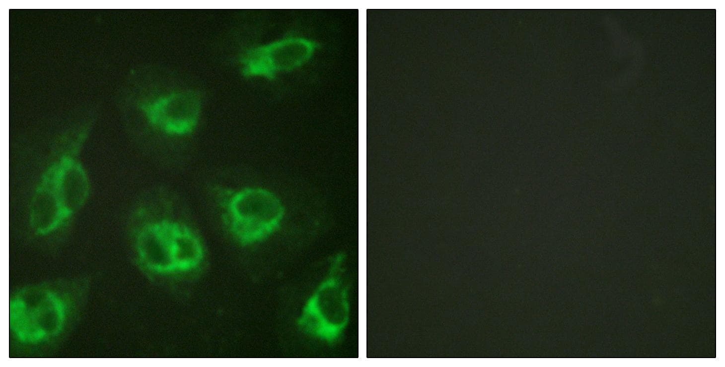 KCNIP3 / Dream / Calsenilin Antibody (p63)