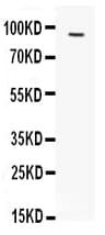 Polyclonal Rabbit anti-Human FES Antibody (aa808-822, WB)