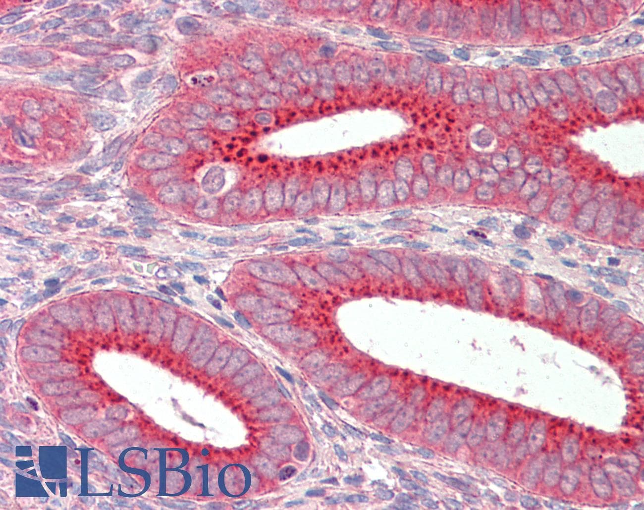 IHC-plus™ SNX1 Antibody (aa122-135)