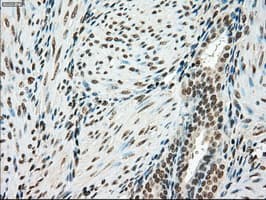 SSB / La Antibody (clone OTI2C8)