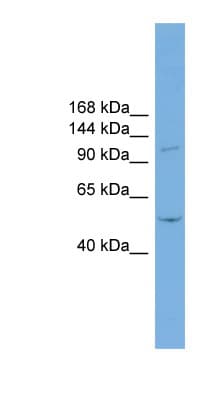TNNI3K / CARK Antibody (aa300-349)