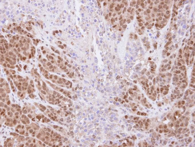 Polyclonal Rabbit anti-Human TRIM21 / RO52 Antibody (aa254-475, IHC, WB)
