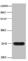 LCN2 / Lipocalin 2 / NGAL Antibody