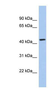 KCTD10 Antibody (C-Terminus)