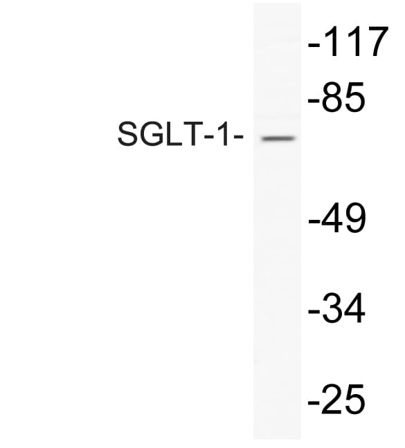 SLC5A1 / SGLT1 Antibody (aa525-574)